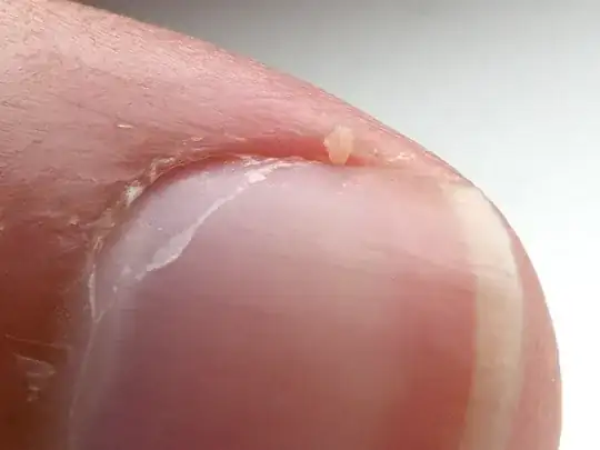 Image from the Wikipedia article