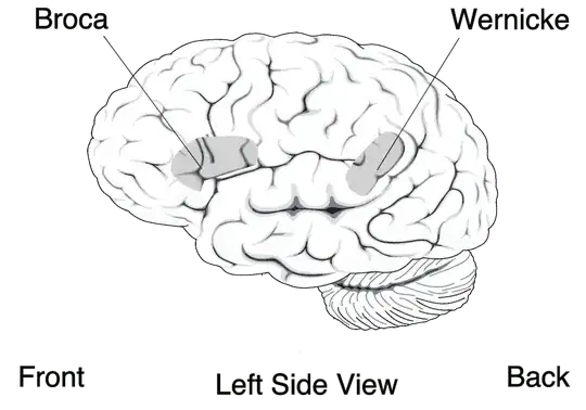 Diagram of the brain showing the location of Broca’s area and Wernicke’s area.