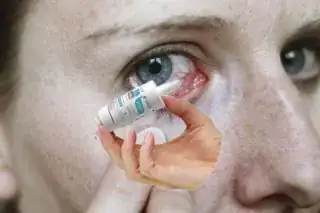 Image of actual application of drops