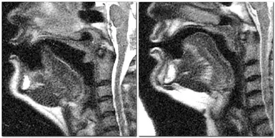 MRI images of apical and bunched /r/, from Zhou et al. (2007), via Ladefoged & Maddieson (2010: 95)