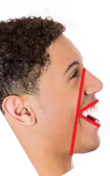 A side view of a face with a superimposed k