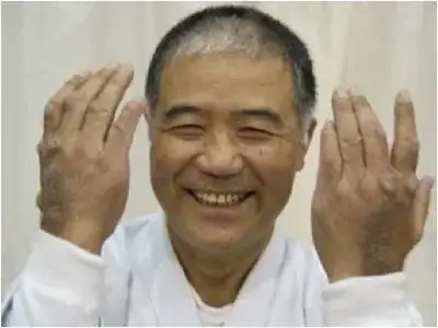 Calloused hands from punching a makiwara