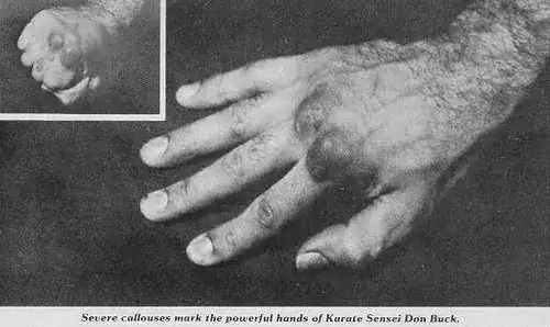 callused knuckles from makiwara training and knuckle press ups