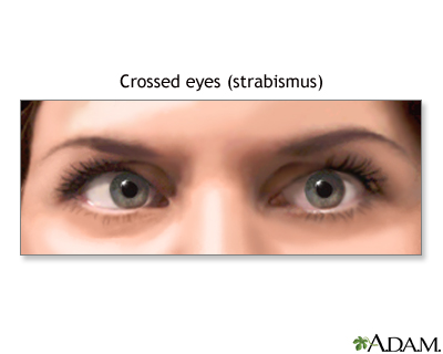 Indications Indications