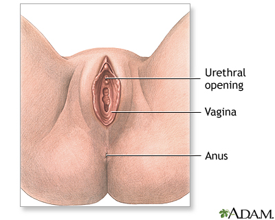 Anterior vaginal wall repair (surgical treatment of urinary incontinence) - series Anterior vaginal wall repair (surgical treatment of urinary incontinence) - series