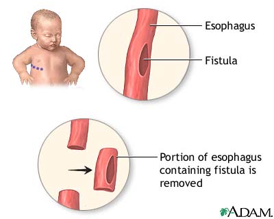 Procedure, part 1 Procedure, part 1
