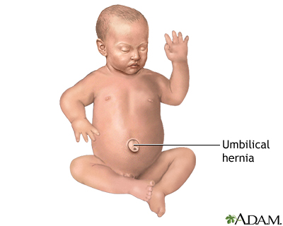 Indications Indications