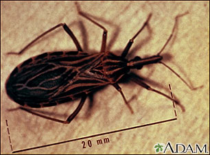 Kissing bug Kissing bug