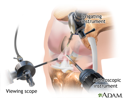 Procedure, part 1 Procedure, part 1