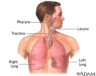 Lung transplant - series Lung transplant - series