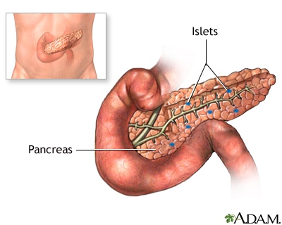 Pancreas transplant - series Pancreas transplant - series