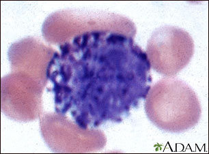 Basophil (close-up) Basophil (close-up)