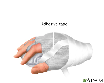 Indications, part 2 Indications, part 2