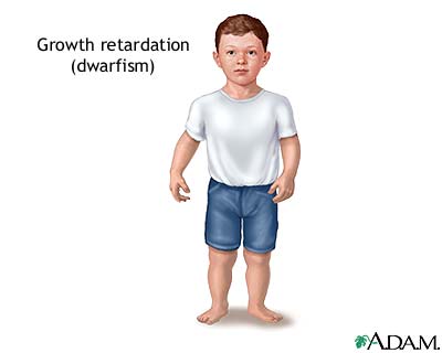 Indications Indications