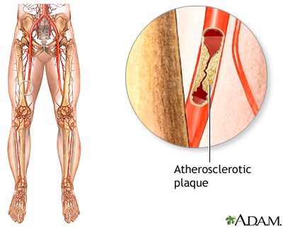 Indication Indication