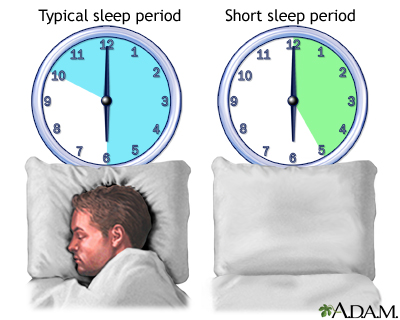 Natural short sleeper