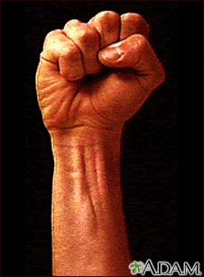 Surface anatomy - normal wrist Surface anatomy - normal wrist