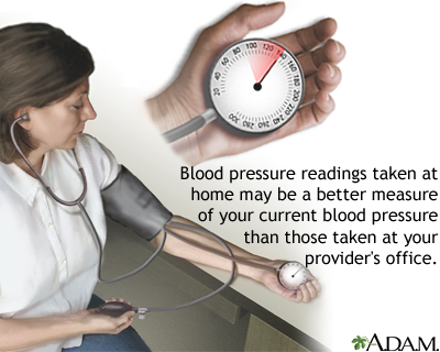 Monitoring blood pressure Monitoring blood pressure