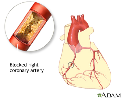 Indication Indication