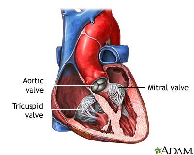 Heart valve surgery - Series Heart valve surgery - Series