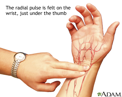 Radial pulse Radial pulse