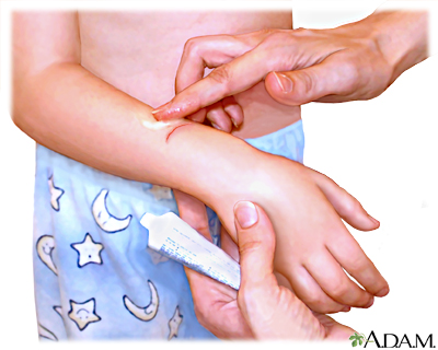 Procedure, part 3 Procedure, part 3