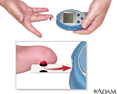 Monitoring blood glucose - Calculate glucose level Monitoring blood glucose - Calculate glucose level