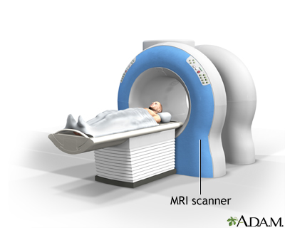 MRI scans MRI scans