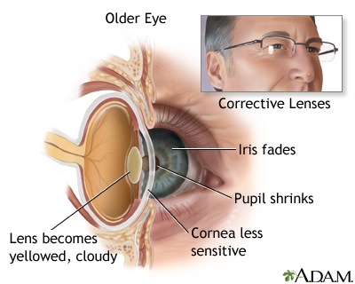 Aged eye anatomy Aged eye anatomy