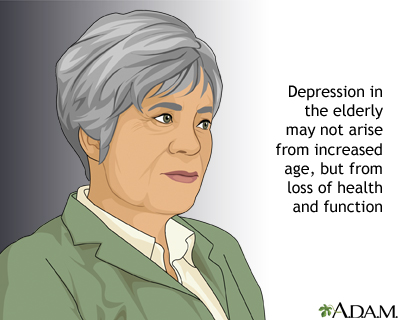 Depression among the elderly Depression among the elderly