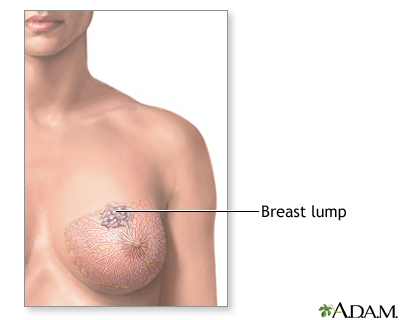 Indications Indications