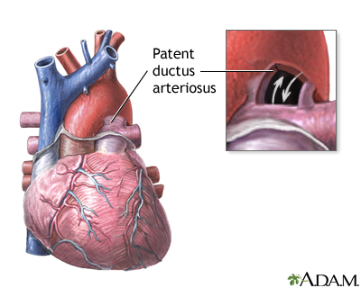 Indications Indications