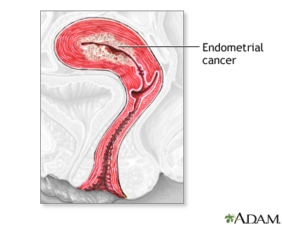 Indication Indication