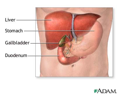 Gallbladder removal - Series