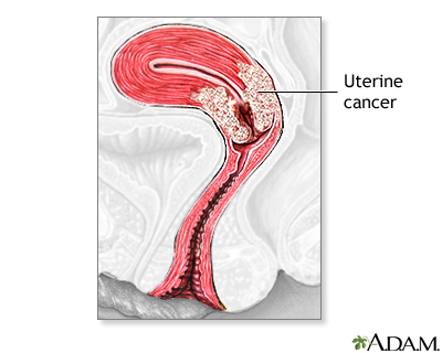 Indications Indications