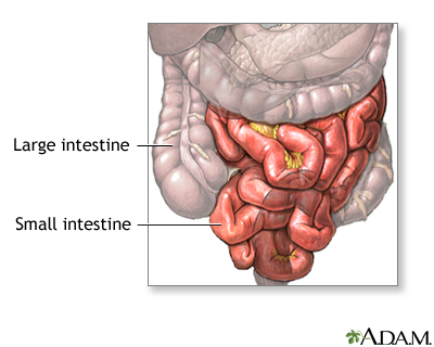 Small bowel resection - series Small bowel resection - series