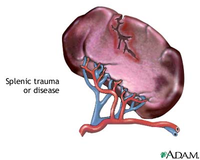 Indications Indications