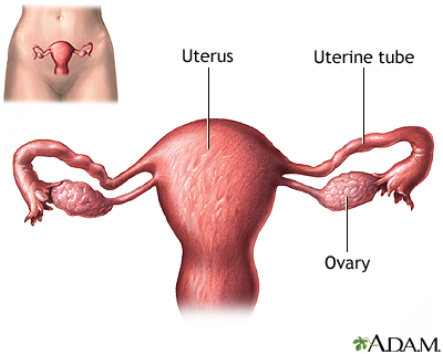 Tubal ligation - uterine anatomy Tubal ligation - uterine anatomy