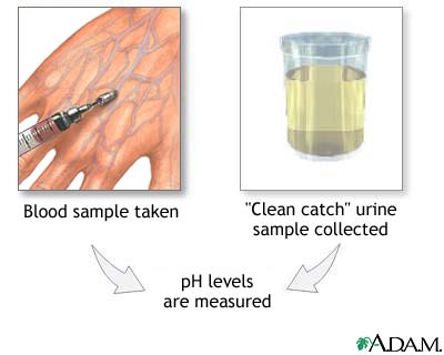 PH urine test PH urine test