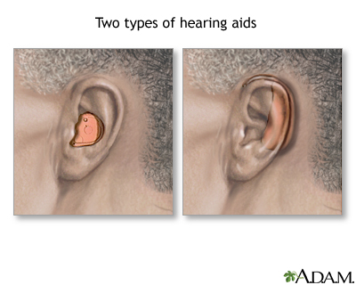Hearing aids Hearing aids