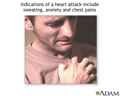 Symptoms of heart attack Symptoms of heart attack