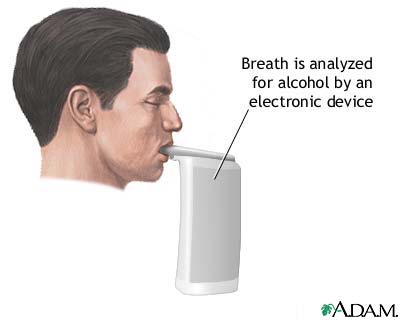 Breath alcohol test Breath alcohol test