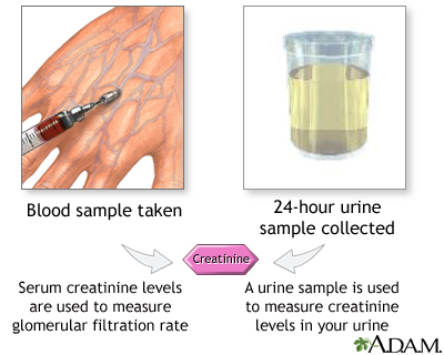 Creatinine tests