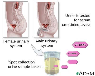 Creatinine urine test Creatinine urine test