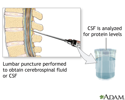 CSF protein test CSF protein test
