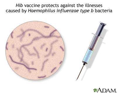 Hib immunization (vaccine) Hib immunization (vaccine)