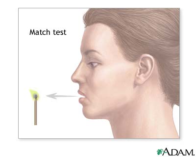 Match test Match test