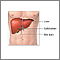 Liver transplant - series Liver transplant - series