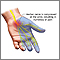 Carpal tunnel syndrome Carpal tunnel syndrome