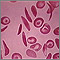 Red blood cells - multiple sickle cells